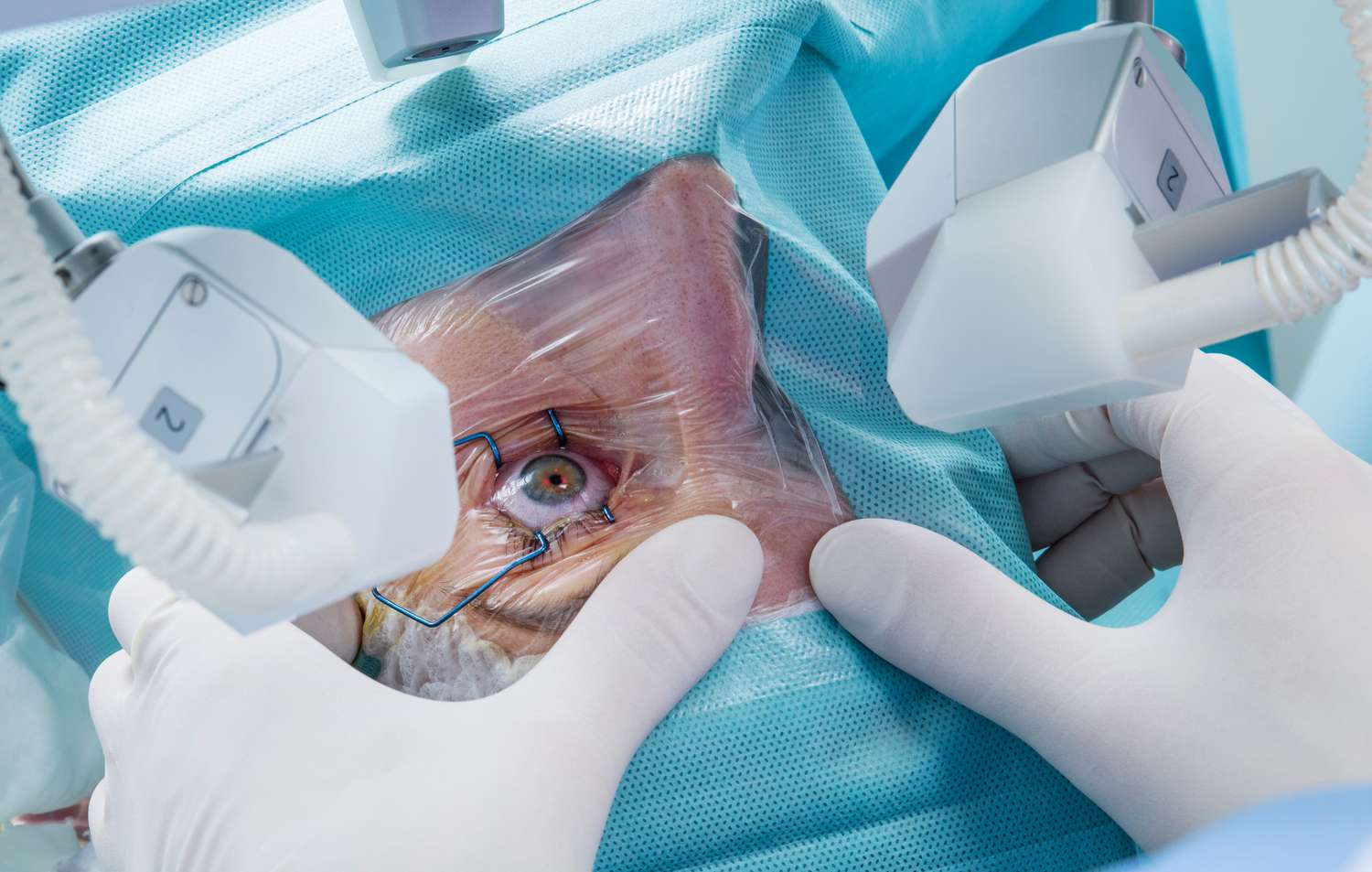 Read more about the article Laser Eye Surgery Myths Debunked: What’s Fact vs. Fiction?